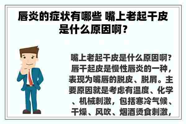 唇炎的症状有哪些 嘴上老起干皮是什么原因啊？